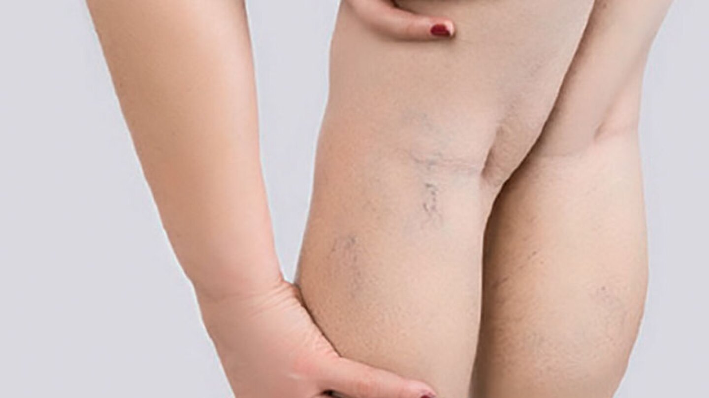 Shutterstock