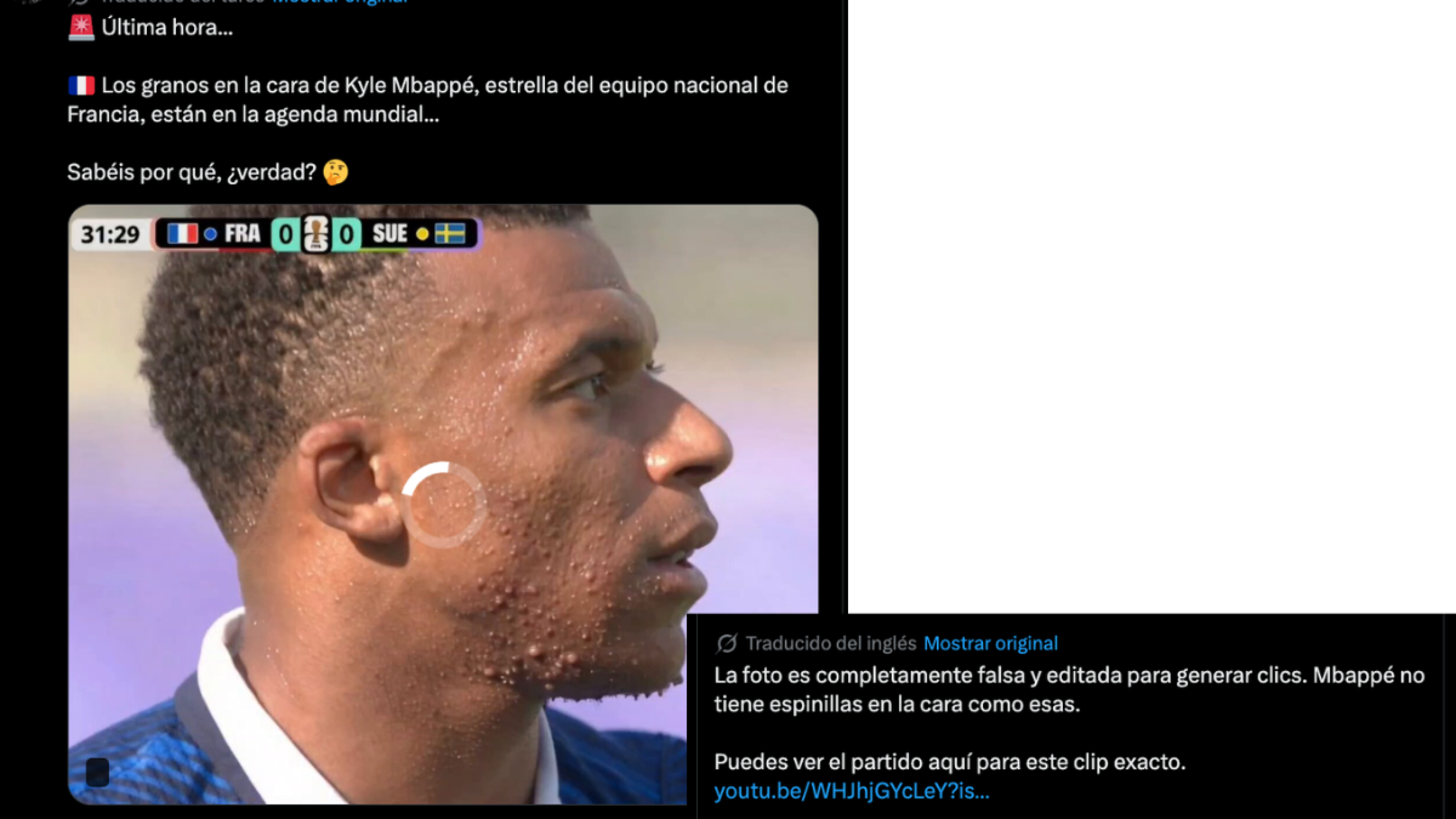 Mbappé