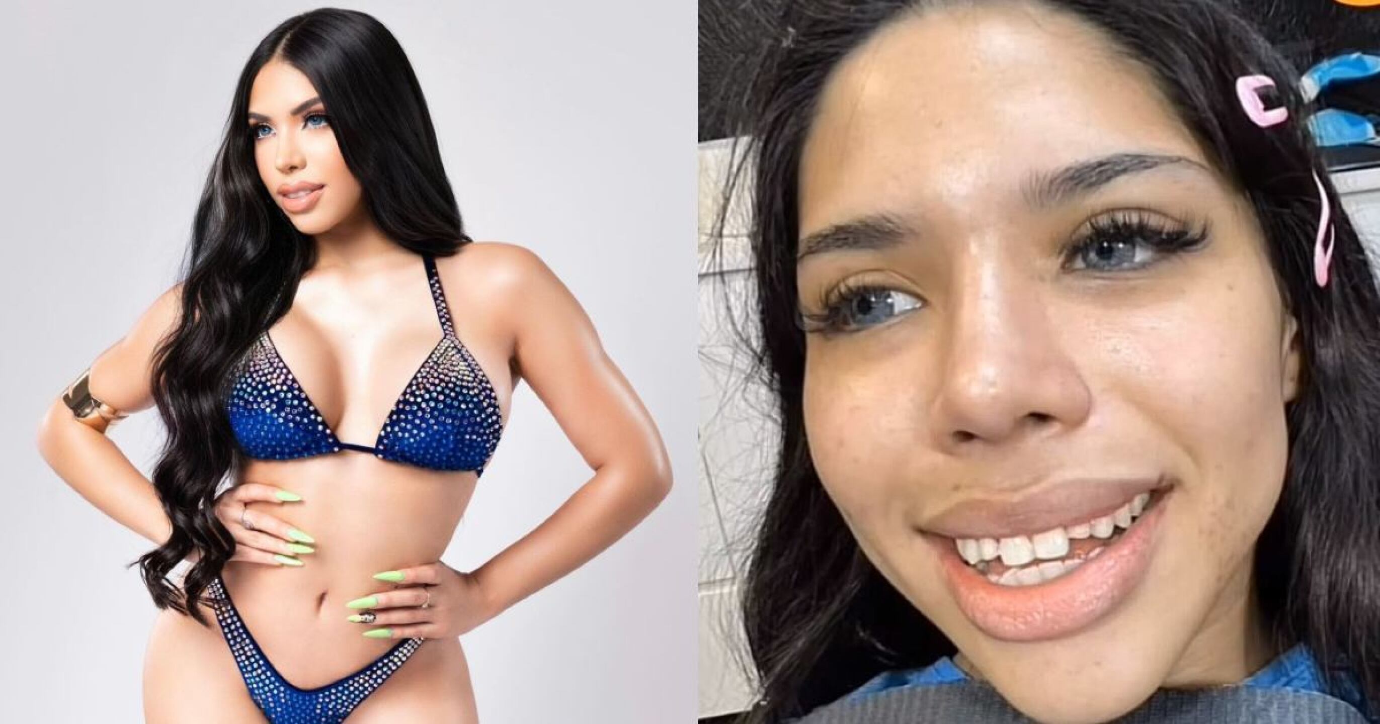 ¿Cuánto ha gastado Yeri MUA en cirugías para su transformación física?