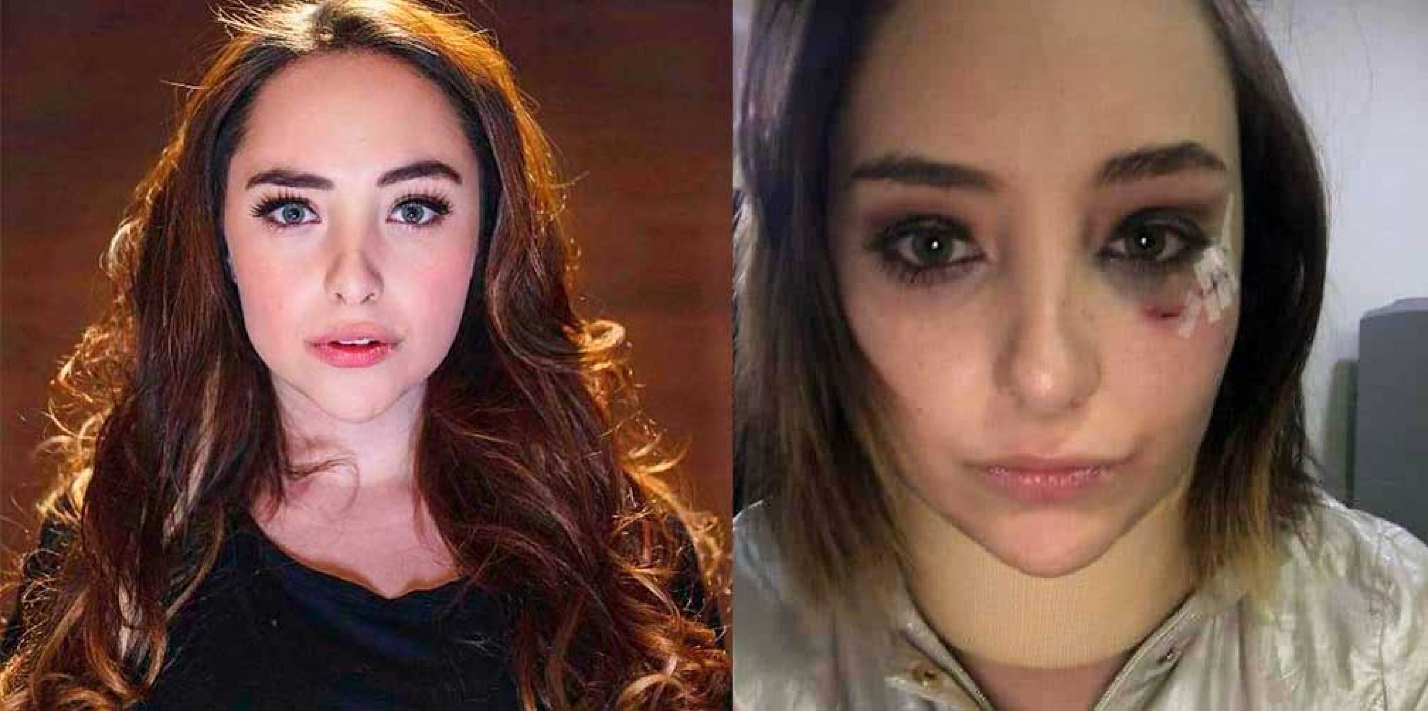 Elisa Vicedo habla sobre su agresor