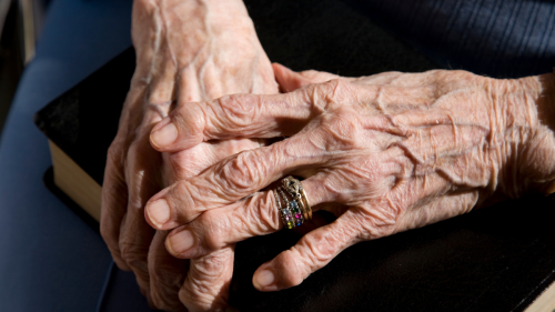 Vejez manos arrugadas.png