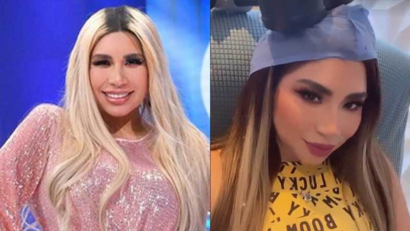 La Bebeshita comenzó con una costosa terapia