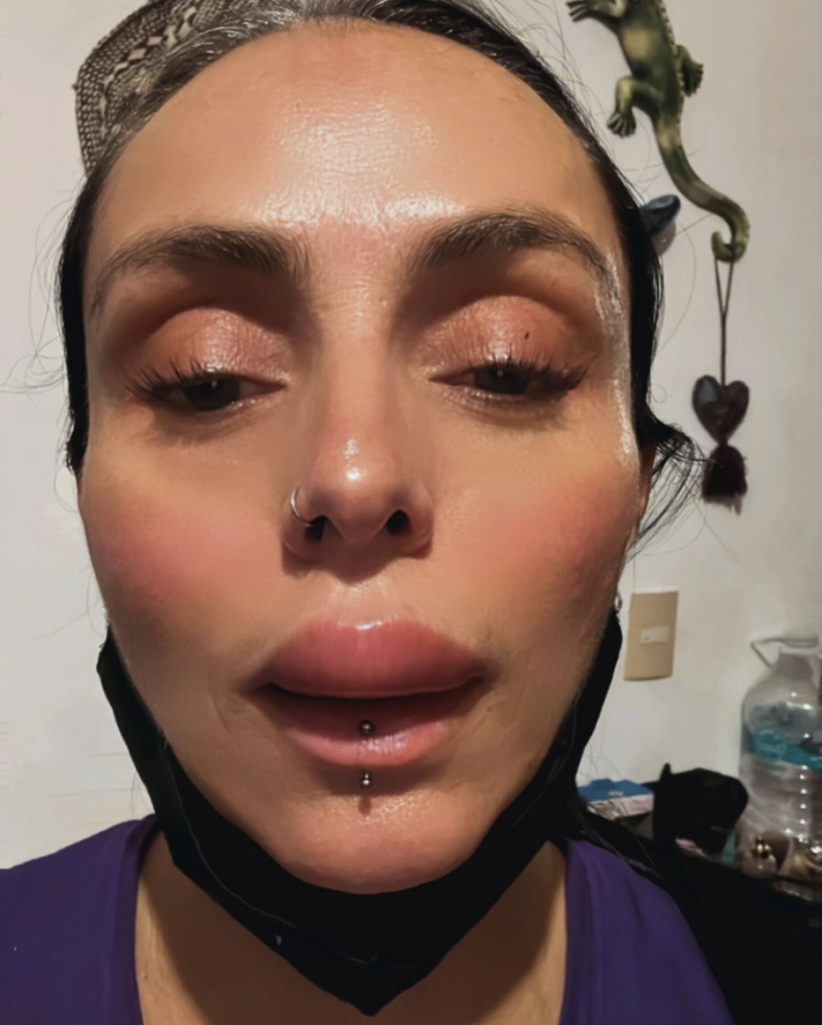 Ivonne Montero sorprende con el rostro desfigurado