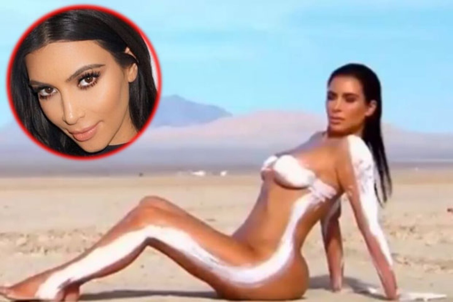 Kim Kardashian sufre de psoriasis.