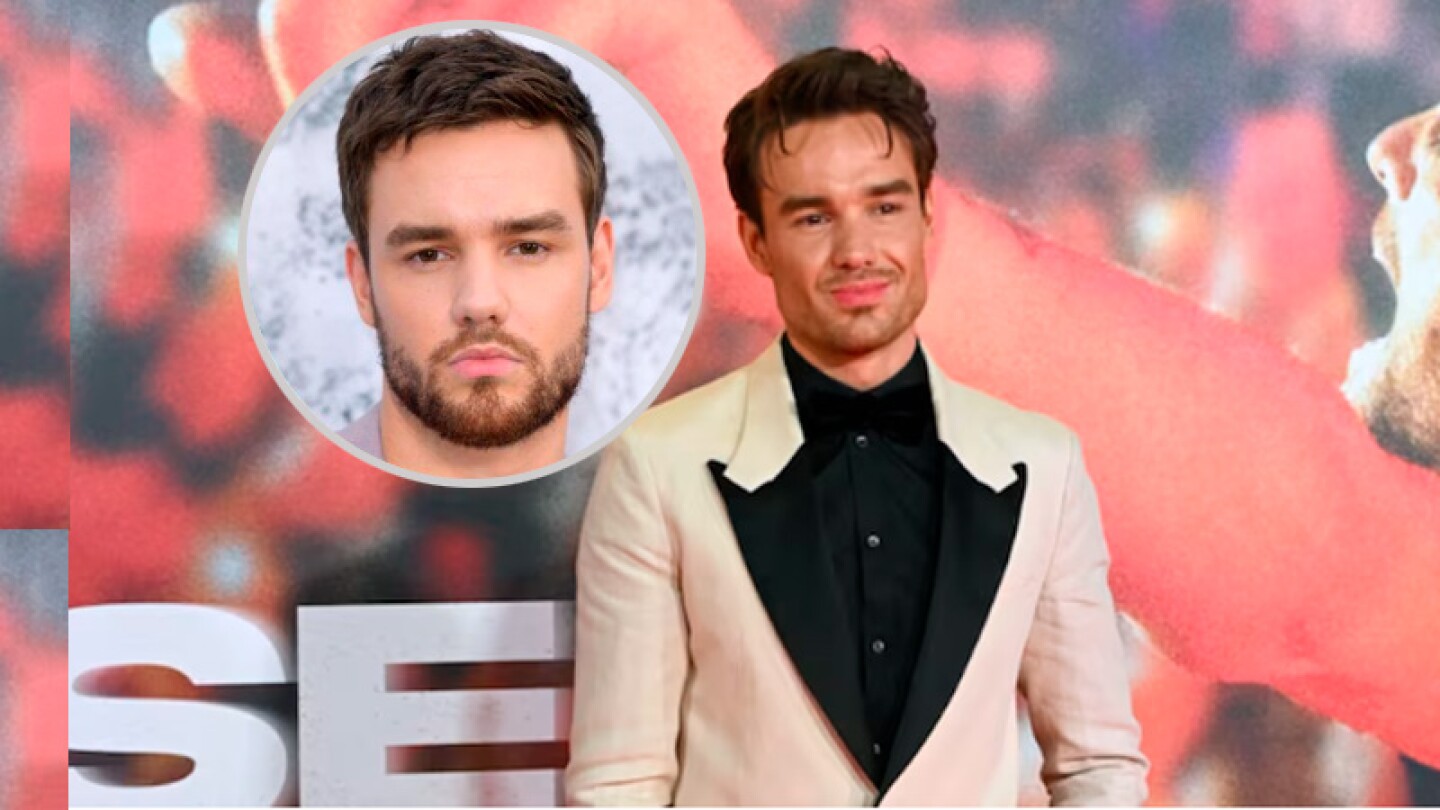 Liam Payne, ex One Direction, aparece con rostro nuevo y divide opiniones: “¿Otro Zac Efron?”