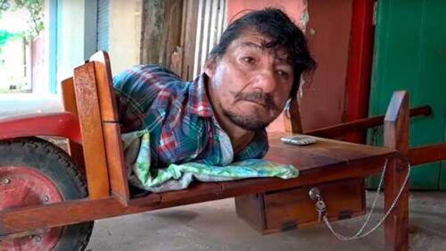 Pablo Acuña es un hombre sin extremidades