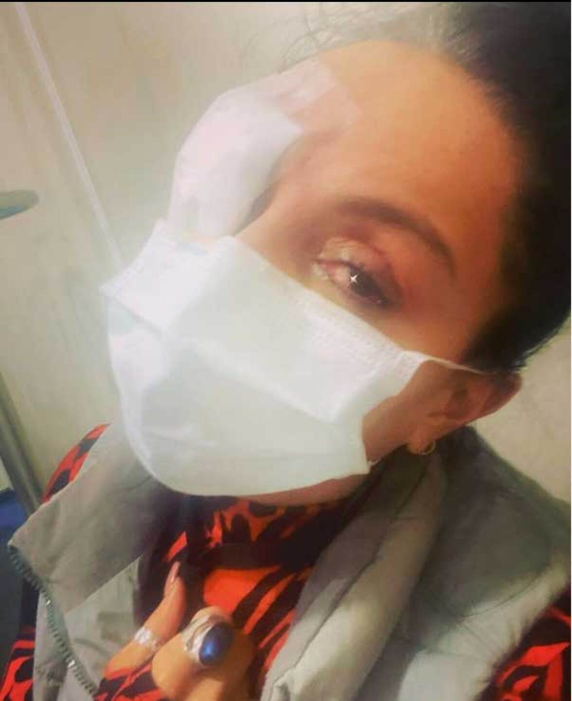 Ivonne Montero sejó ver se con un ojo lastimado