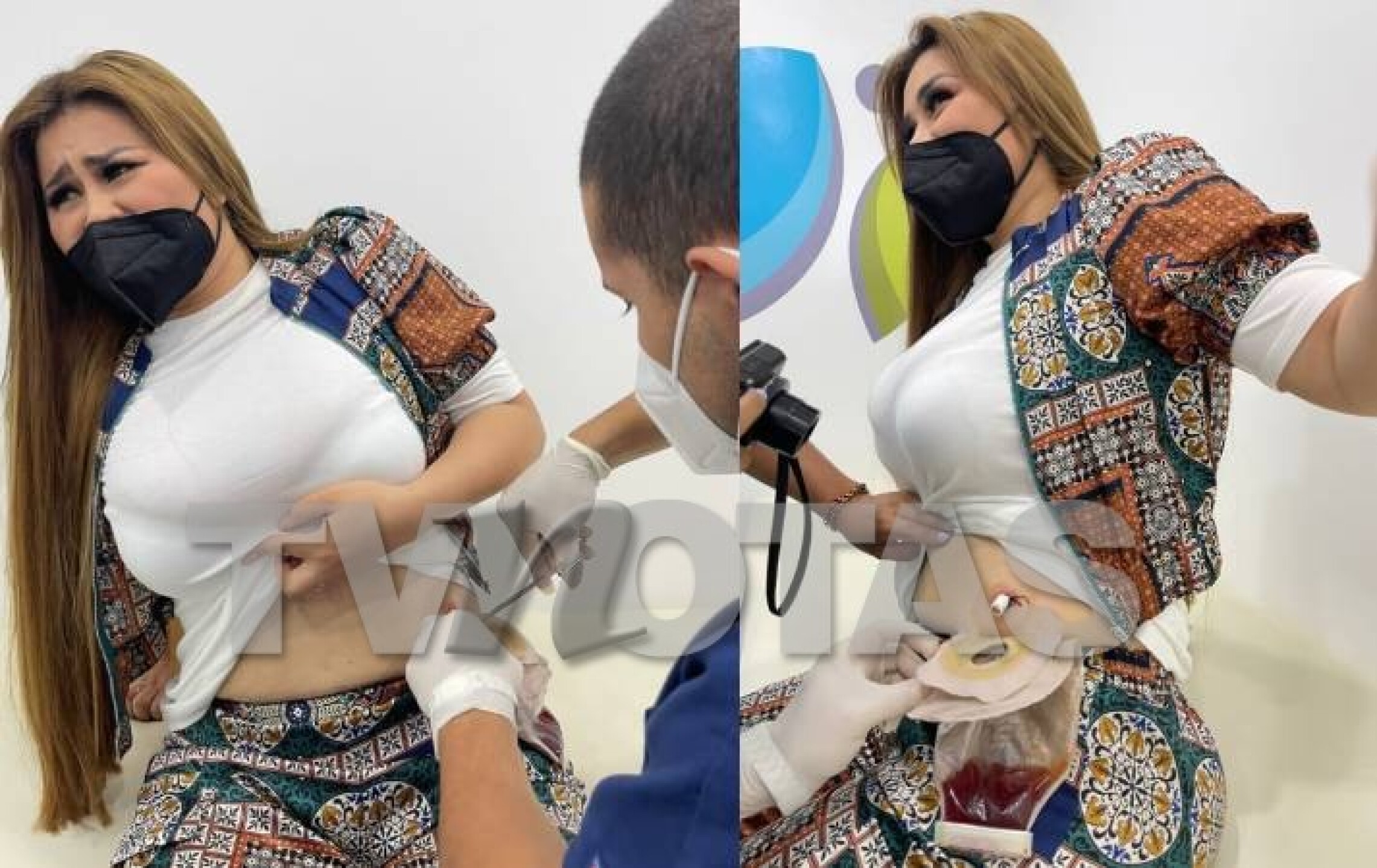 gomita_cirugias_bypass_60kilos_tvnotas