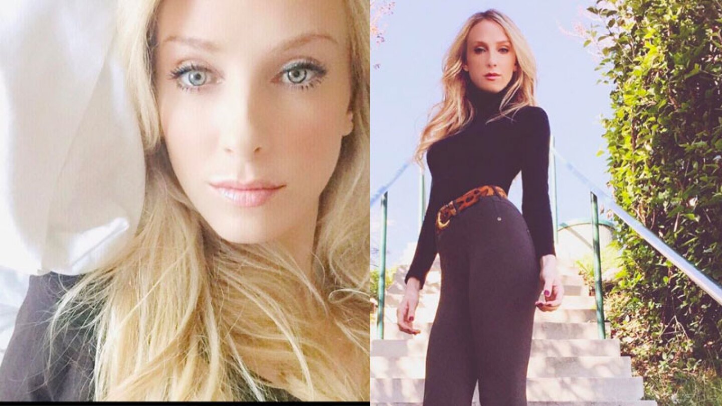 La guapa mujer tiene dos ADN distintos.