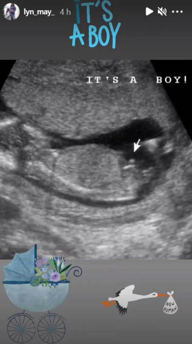 Lyn May está embarazada