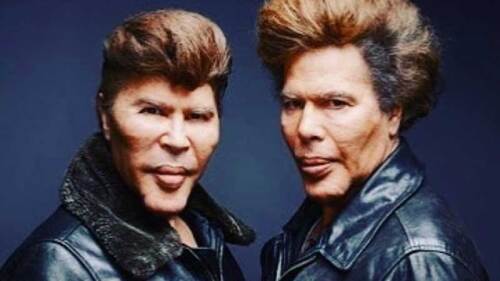 Los gemelos Bogdanoff se contagiaron de Covid