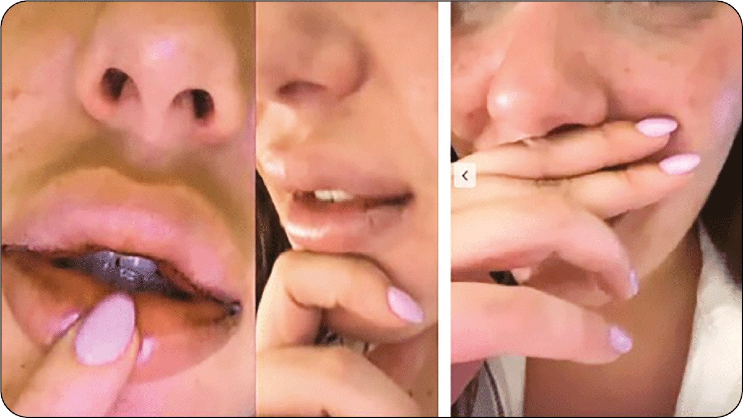 Agresión Isa Castro