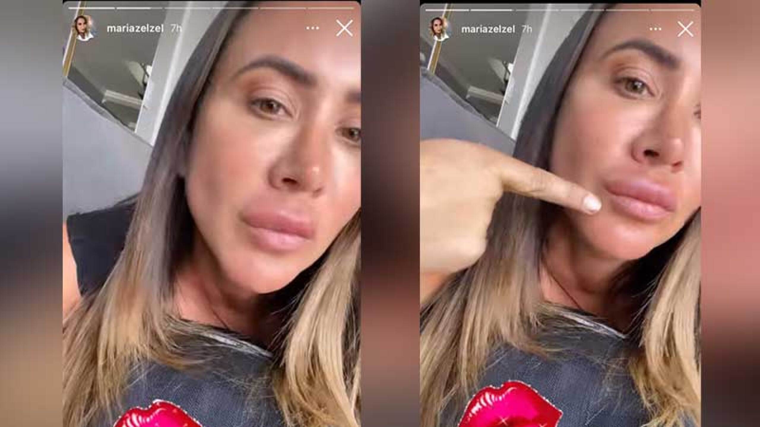 Mariazel aparece desfigurada en Instagram