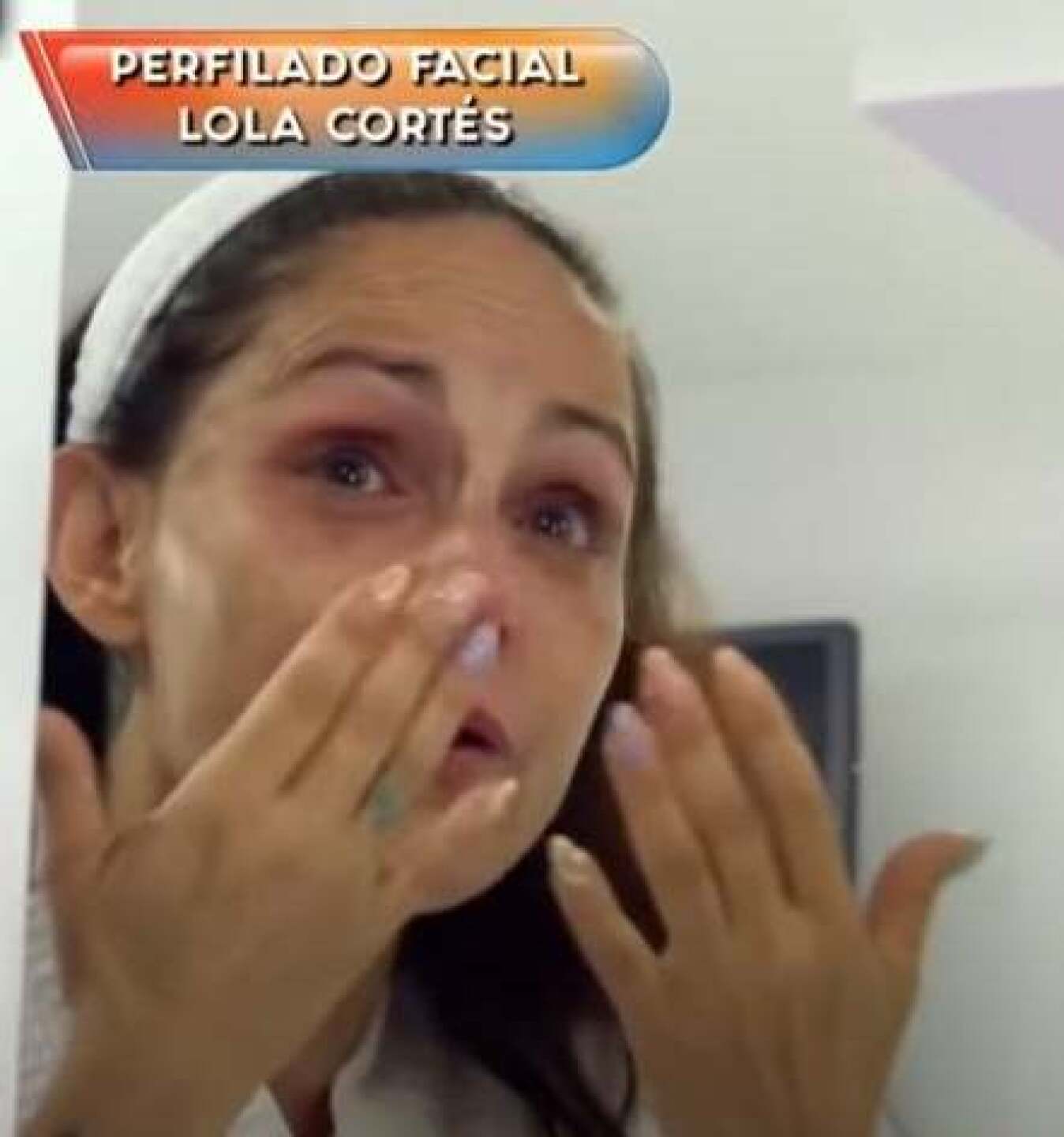 Lolita Cortés rompe llanto resultado  tratamiento estético