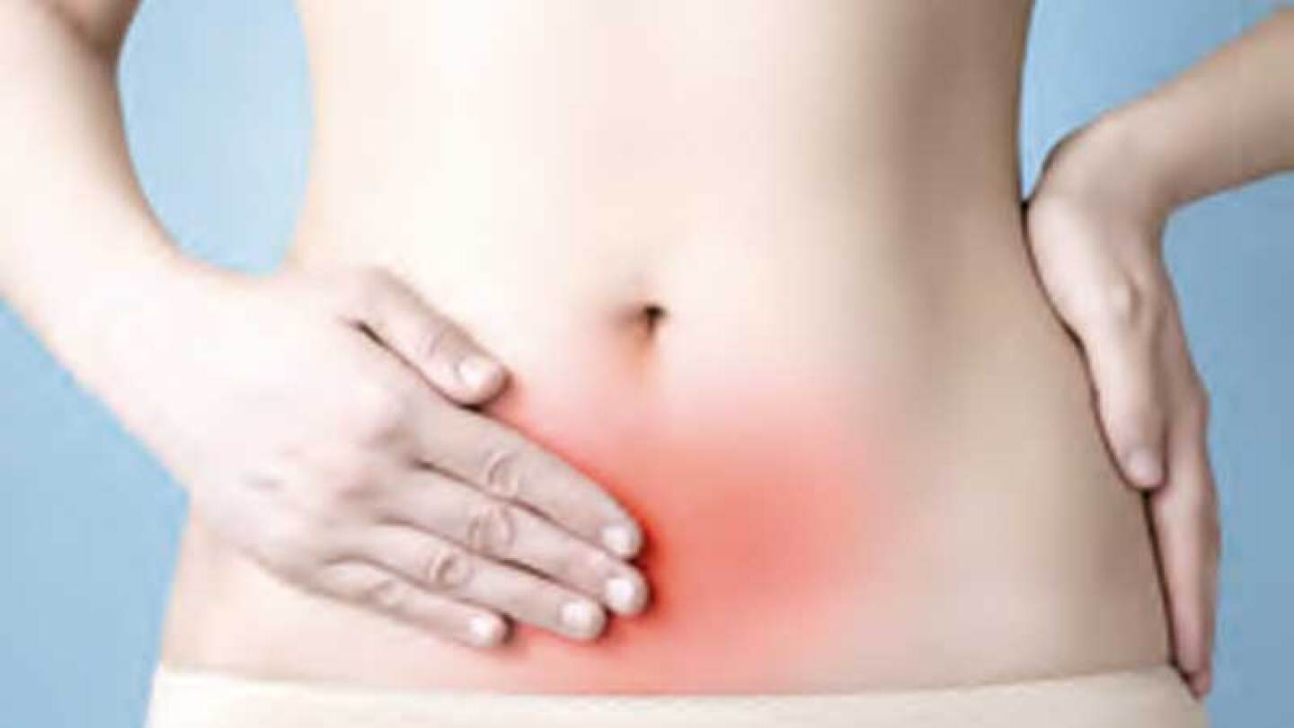La endometriosis es causada por el crecimiento de los tejidos