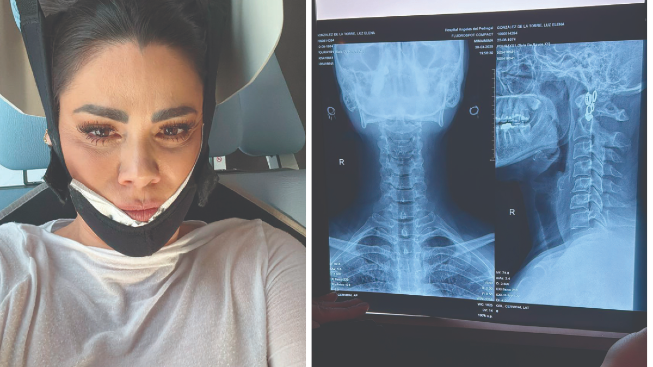 Luz Elena González cayó en vivo y temió lo peor