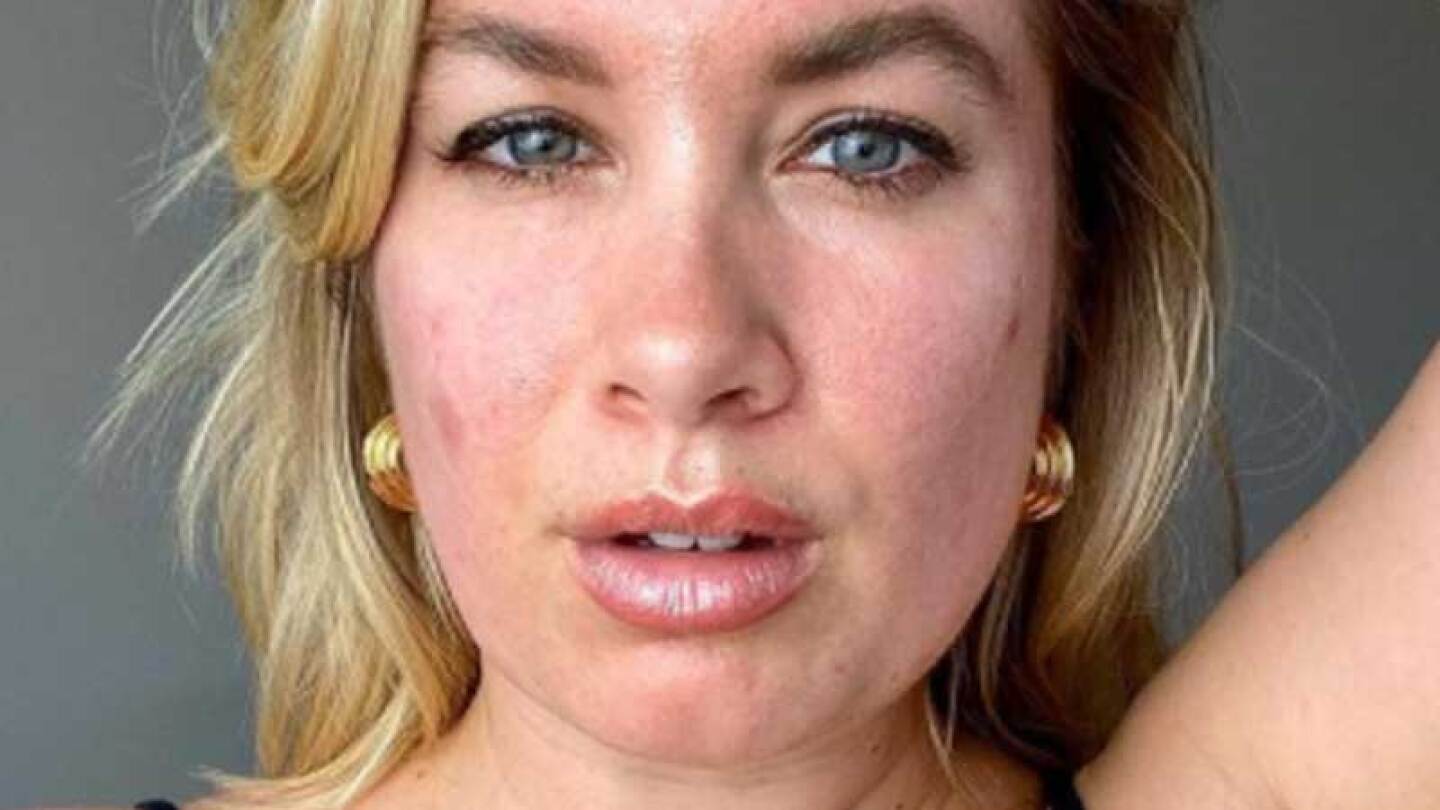 La mujer se hizo viral por dejarse el bigote