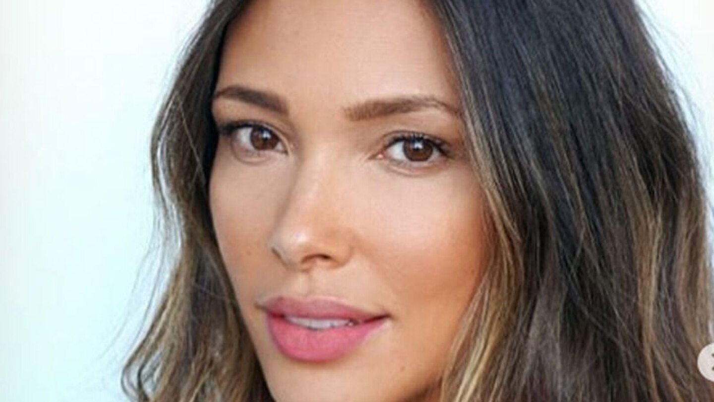Ataque de chinches a modelo de Victoria’s Secret, le deja terribles secuelas