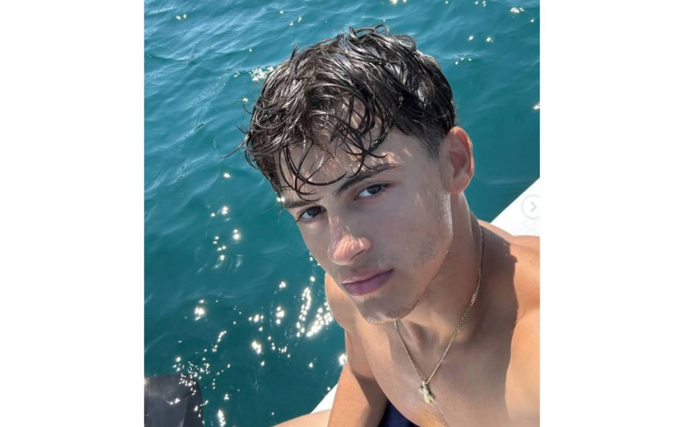 Participante de Survivor accidentado