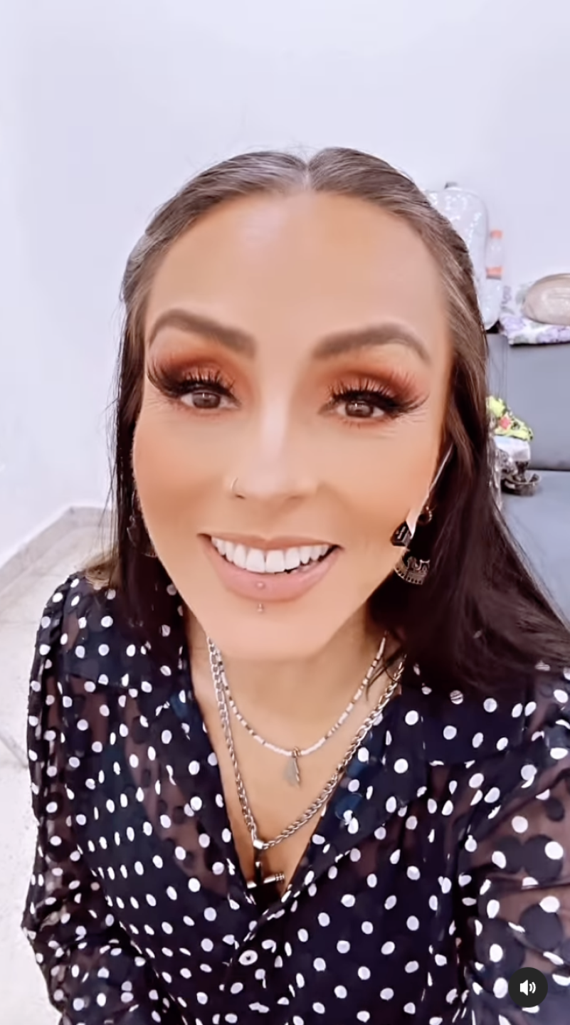 Ivonne Montero sorprende con el rostro desfigurado