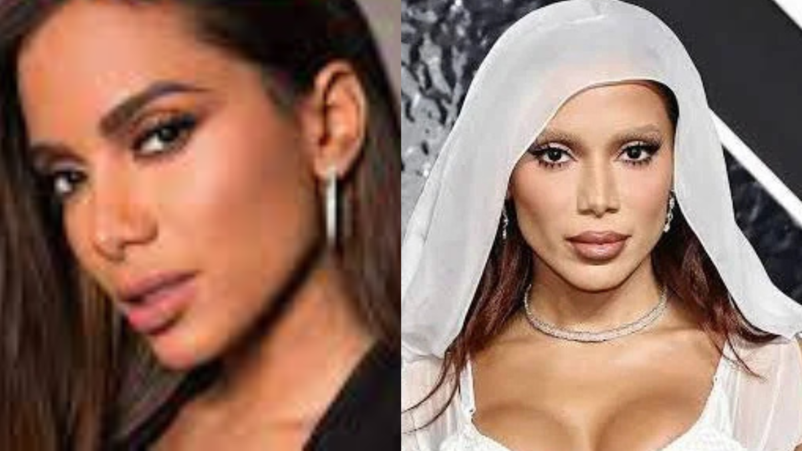 Anitta antes y después