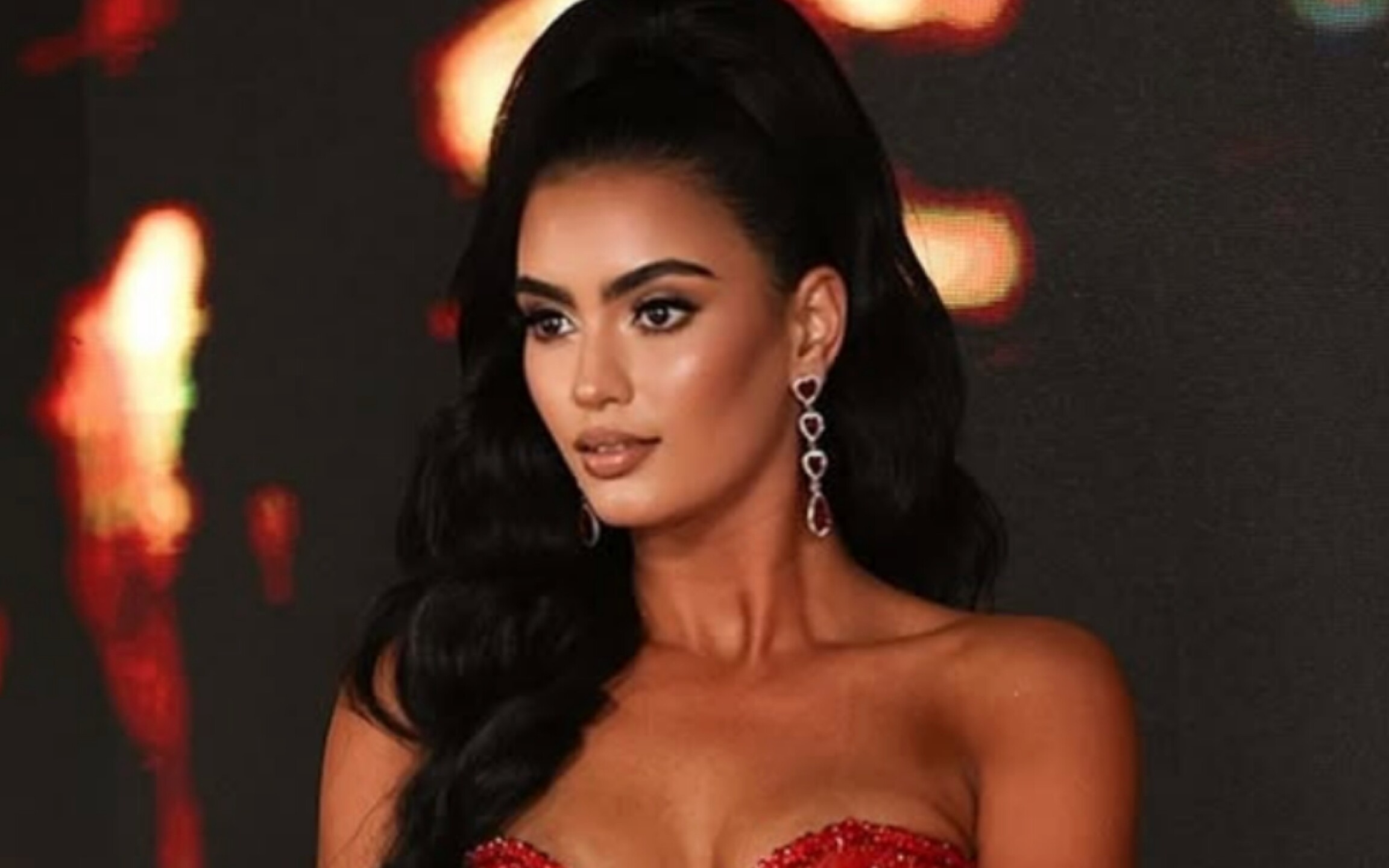 Laura Pérez, modelo accidentada de Miss Universe Latina