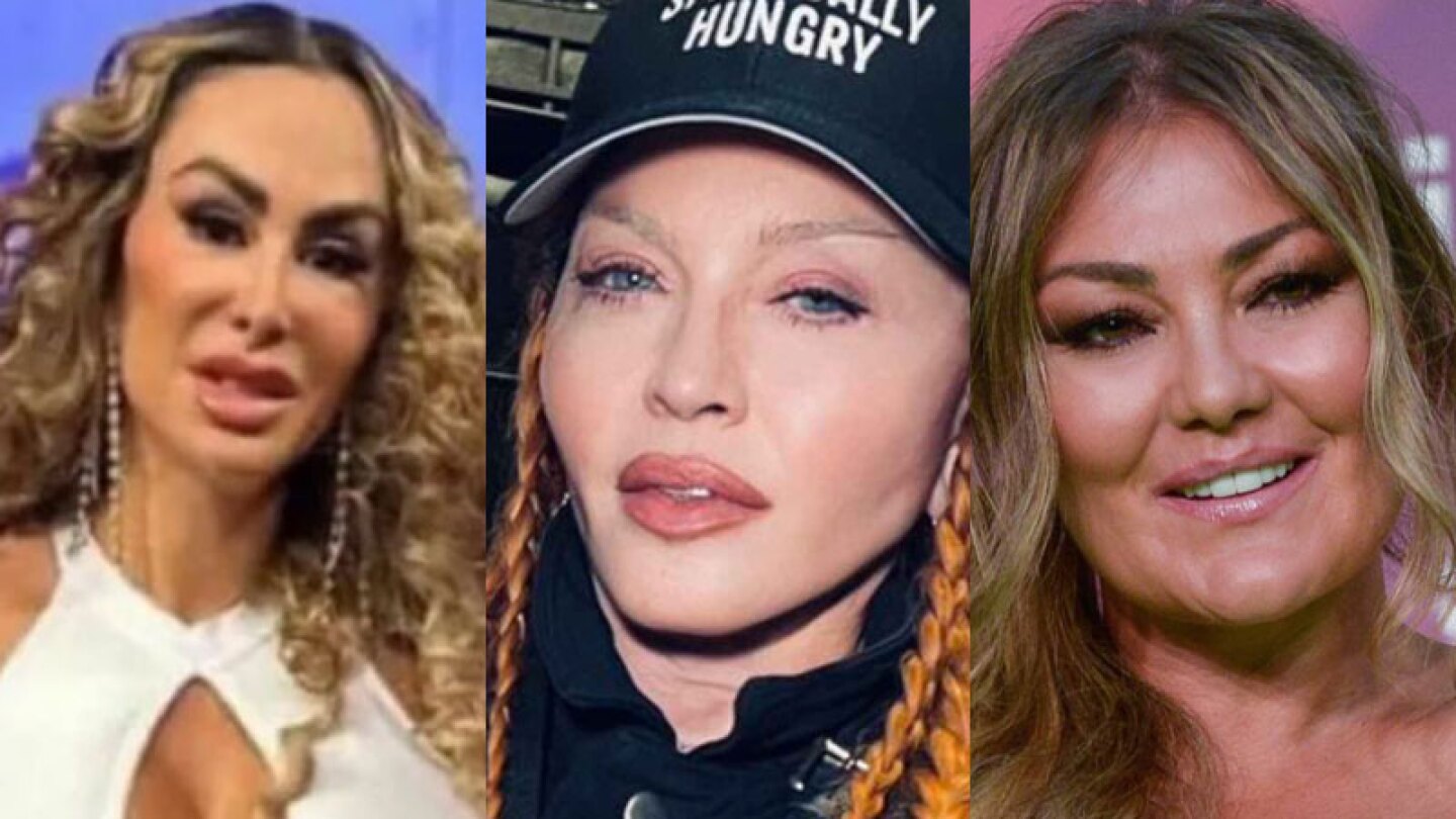 Ninel Conde, Madonna y Amaia Montero, famosas criticadas por sus cirugías