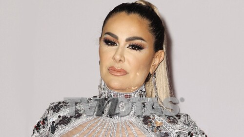 Ninel Conde estrena cirugía estética para comenzar a grabar su bioserie