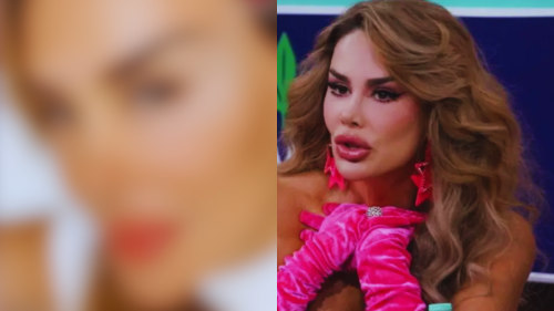 Ninel Conde se somete a cirugía considerada "riesgosa" para cambiar una parte de su cuerpo. ¿Qué se hizo?