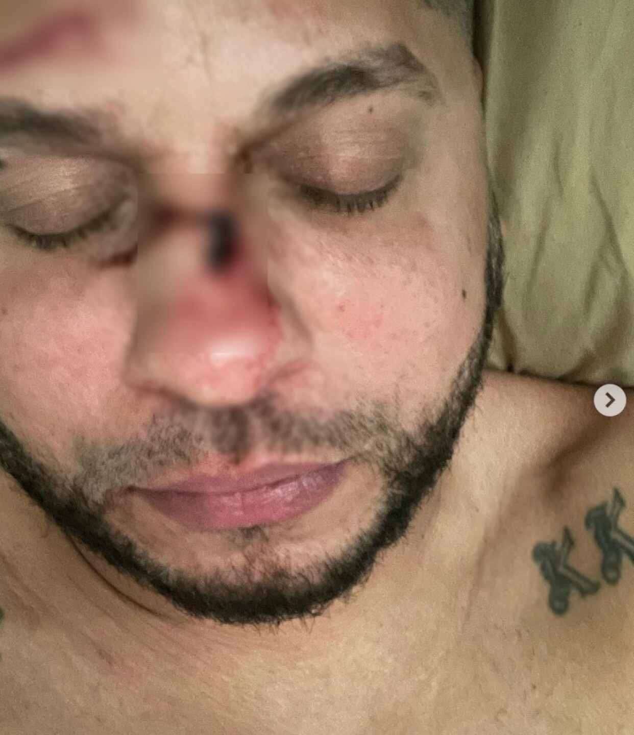 Tempo, reguetonero, sufre accidente automovilístico