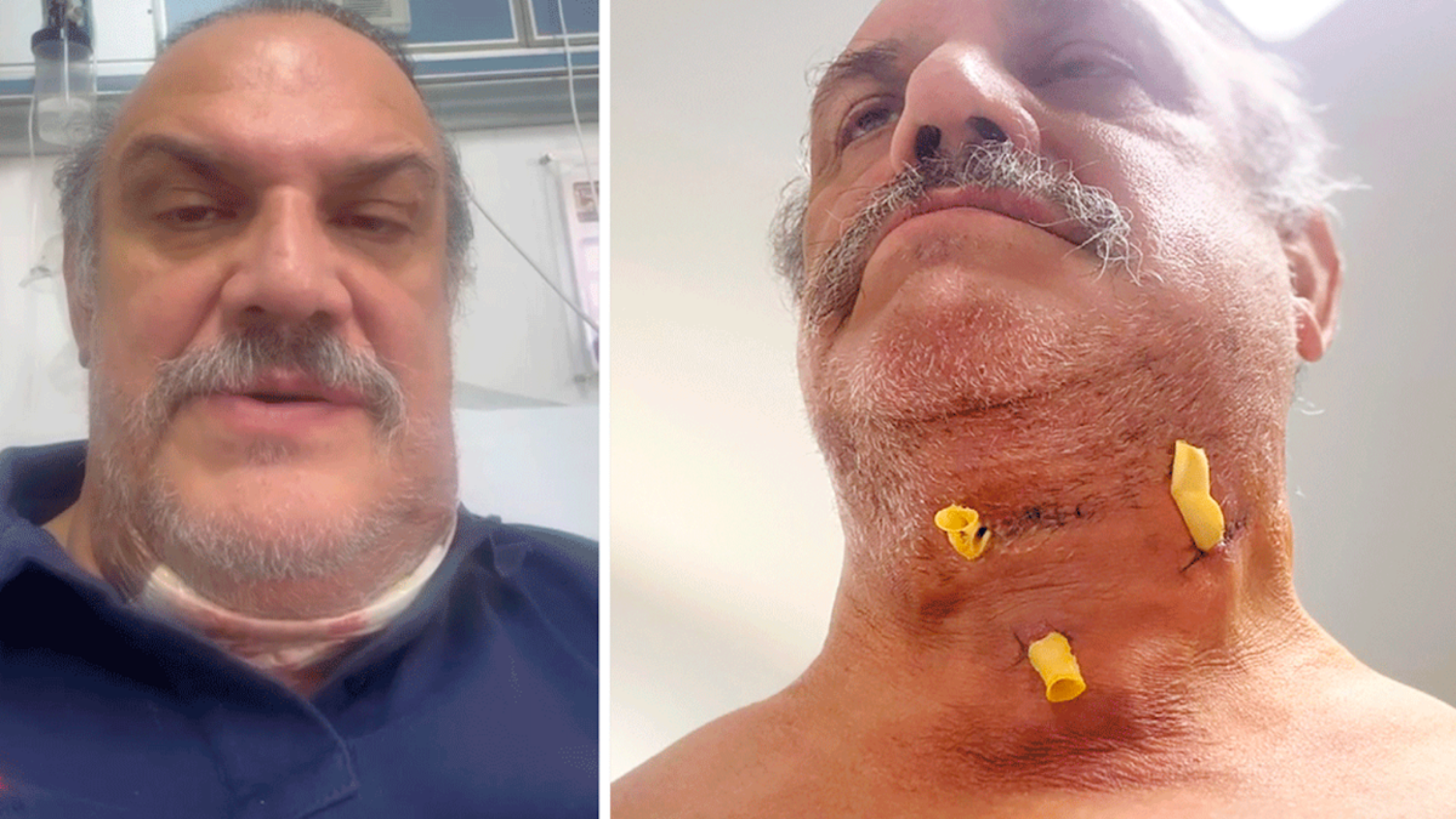 Héctor Cruz Lara sufrió enfermedad