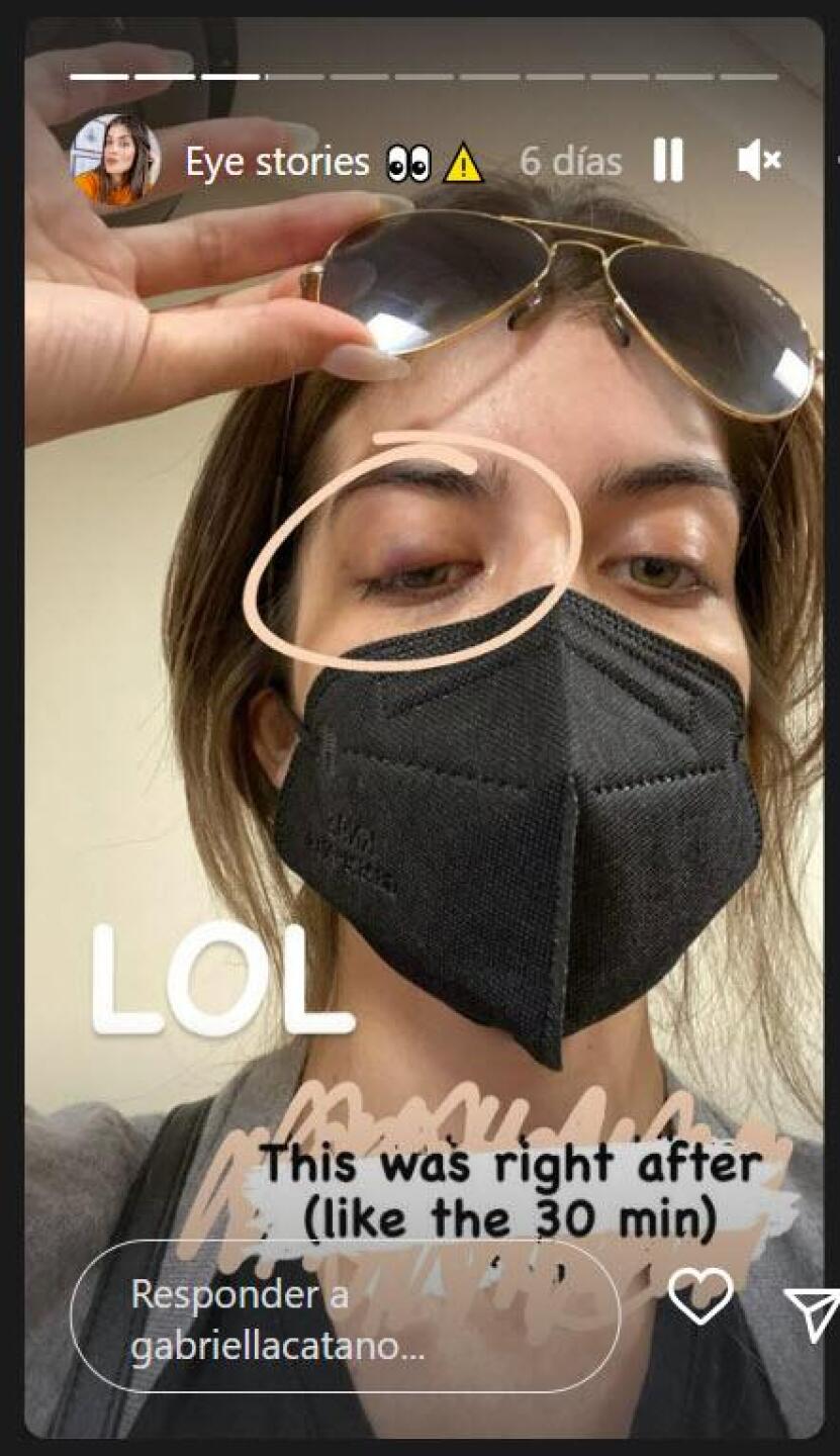 Hija mayor de Jorge Salinas se realiza cirugía en el rostro