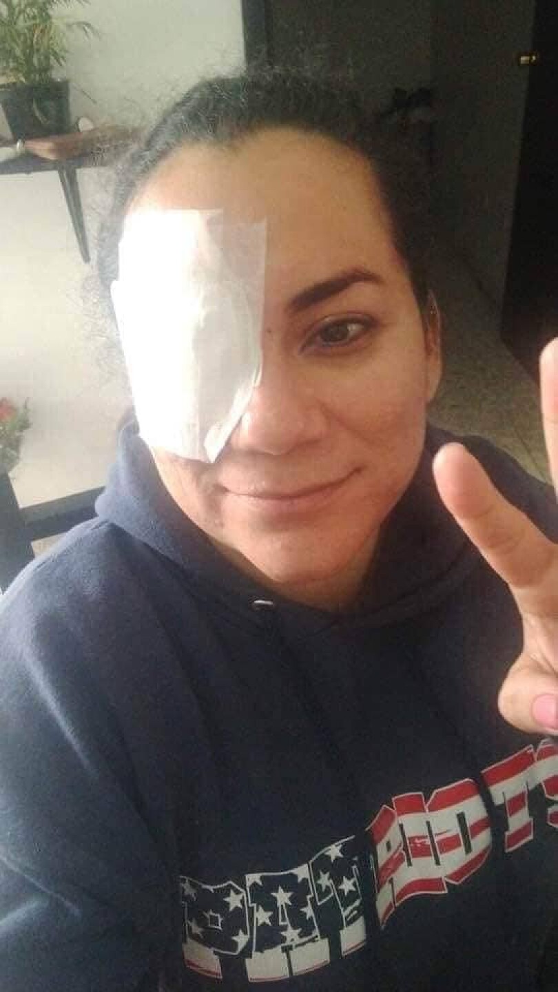 Por medio de otra foto nos enteramos que la víctima había salido con bien del accidente.