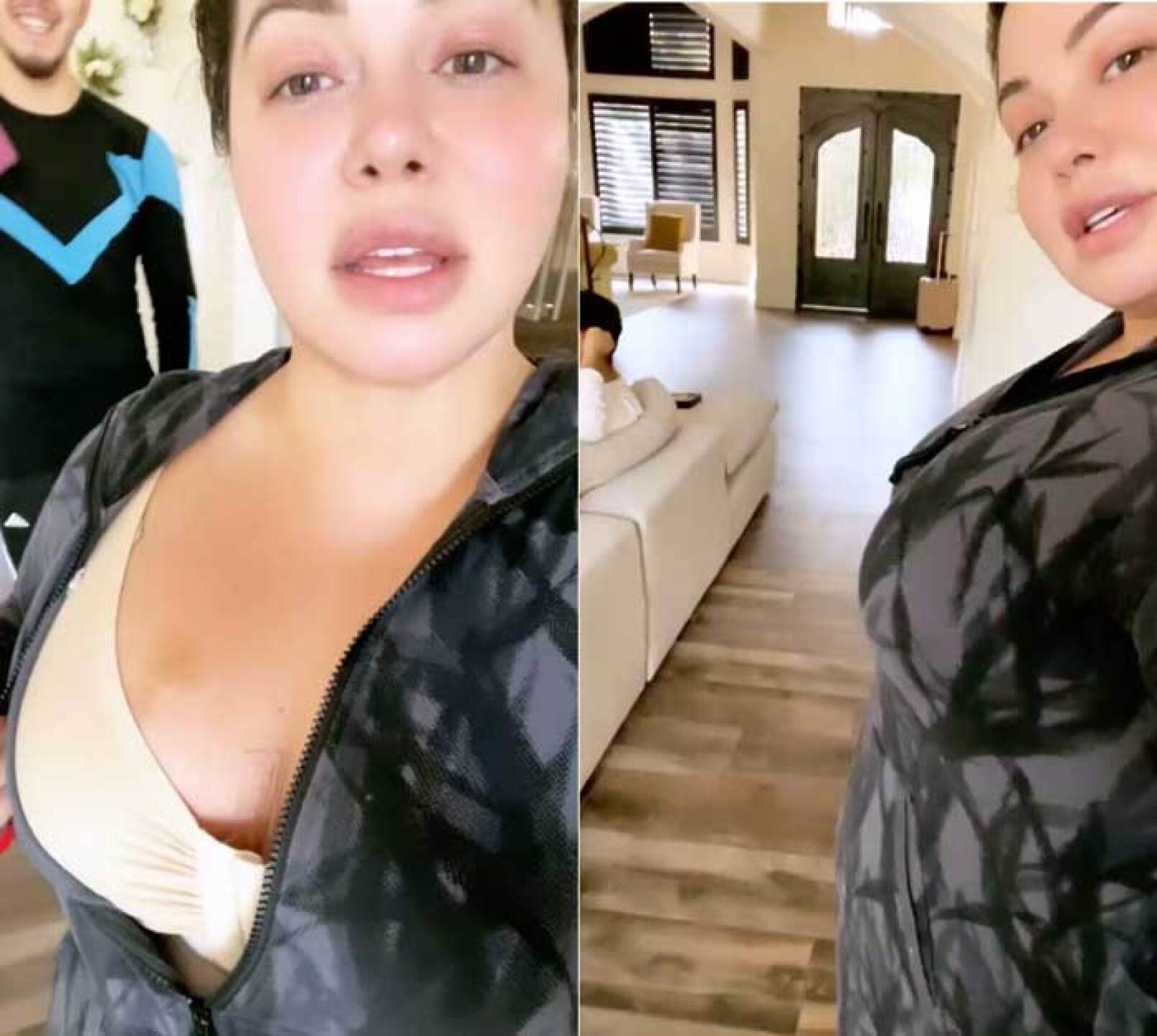 chiquis rivera operación busto resultado cirugía cicatriz