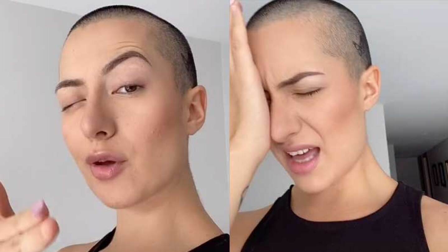 Influencer se pega el ojo con con Kola Loka pensando que eran sus gotas