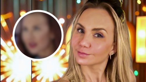 ¿Qué le pasó en la cara a Michelle Vieth? La actriz desata polémica por su nuevo rostro