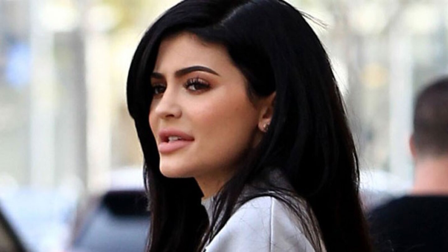 Kylie Jenner labios n