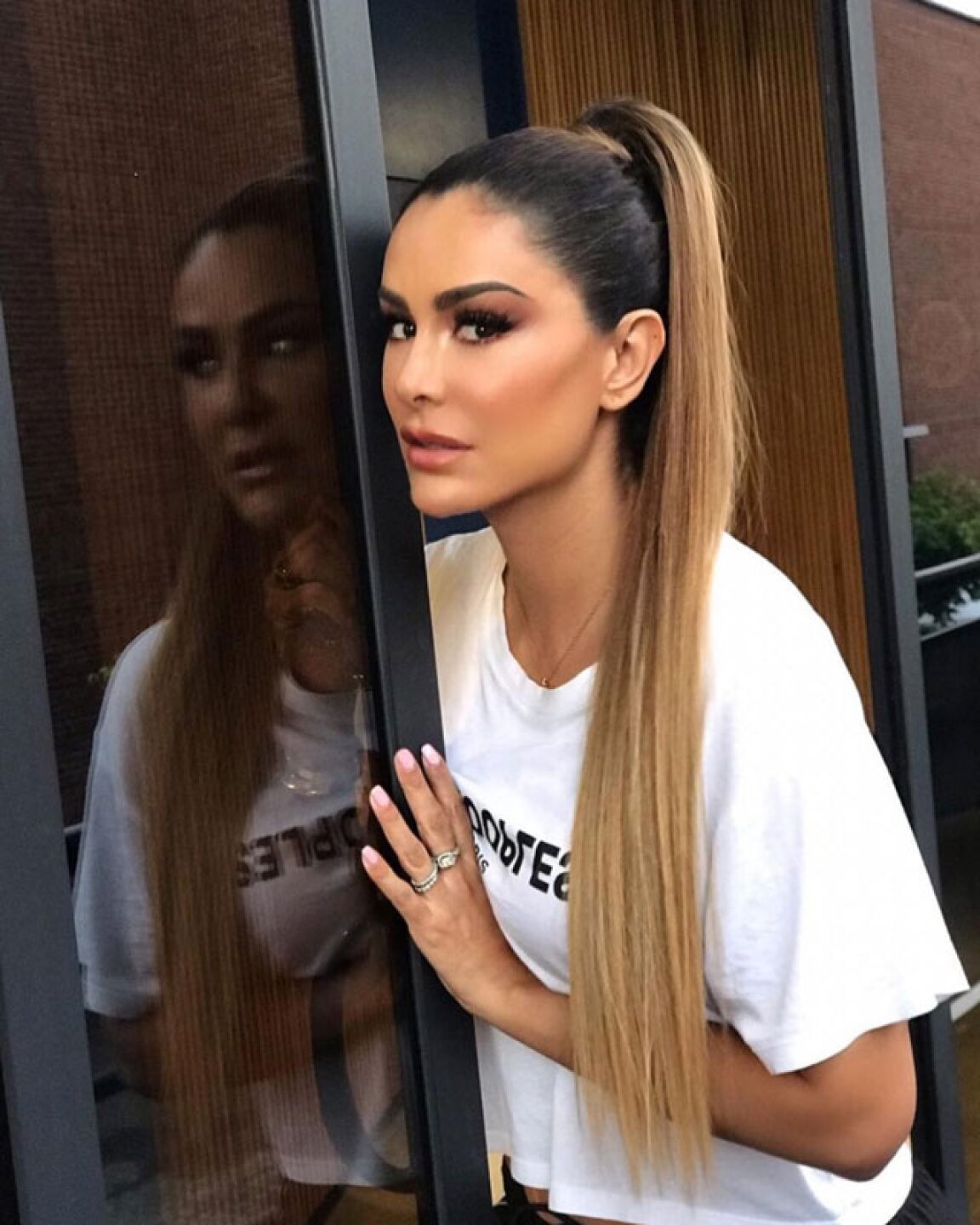 ninel conde fotos golpes moretones