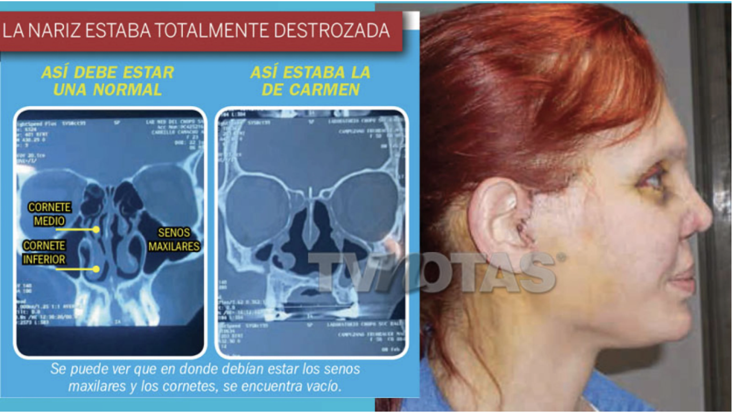 Carmen Campuzano
