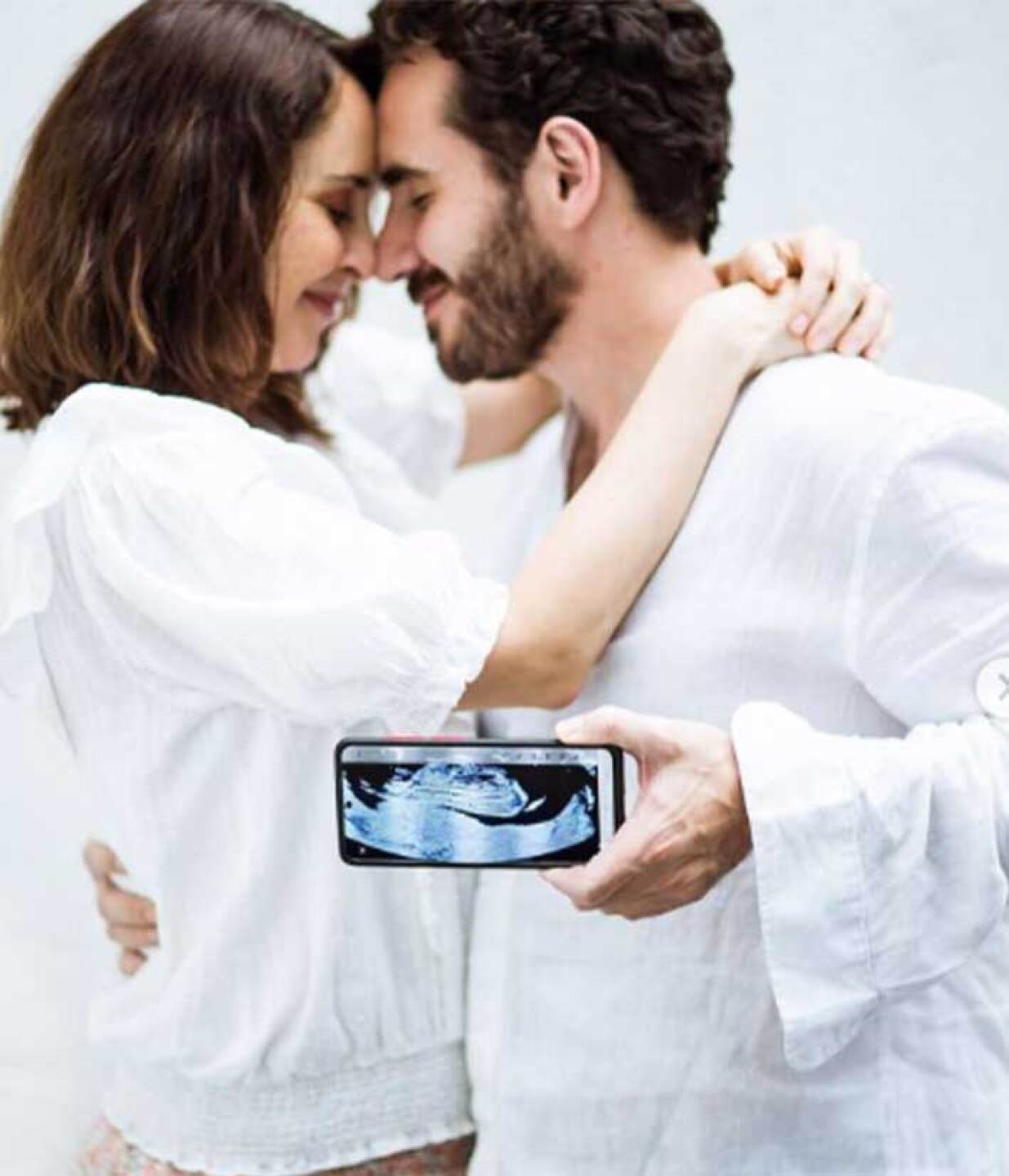 Irán Castillo y pareja.