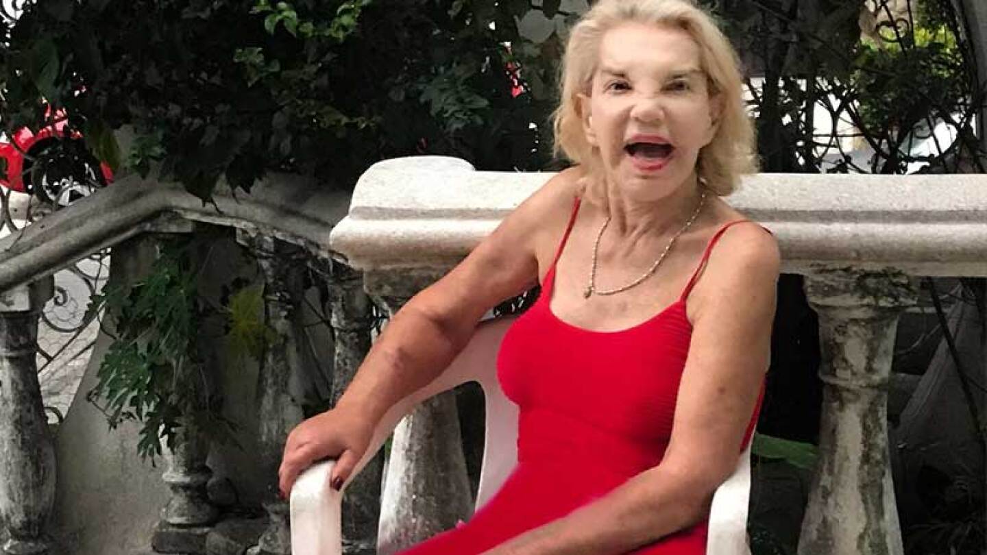 La argentina de 70 años había logrado recuperarse en gran manera.