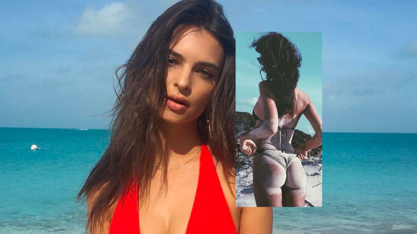 El descuido de Emily Ratajkowski.