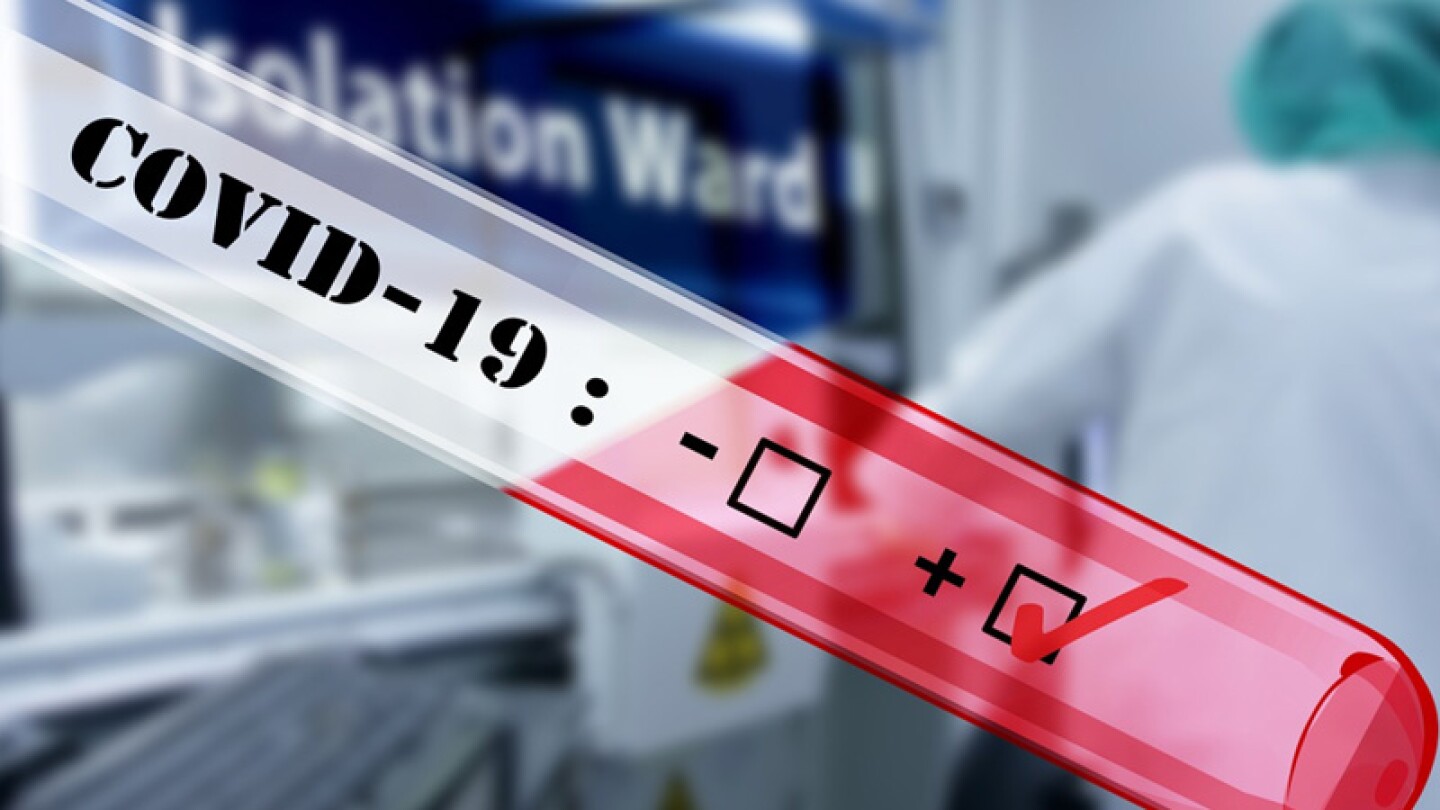 Pierde la vida el doctor chino que cambio de color de piel por Covid-19