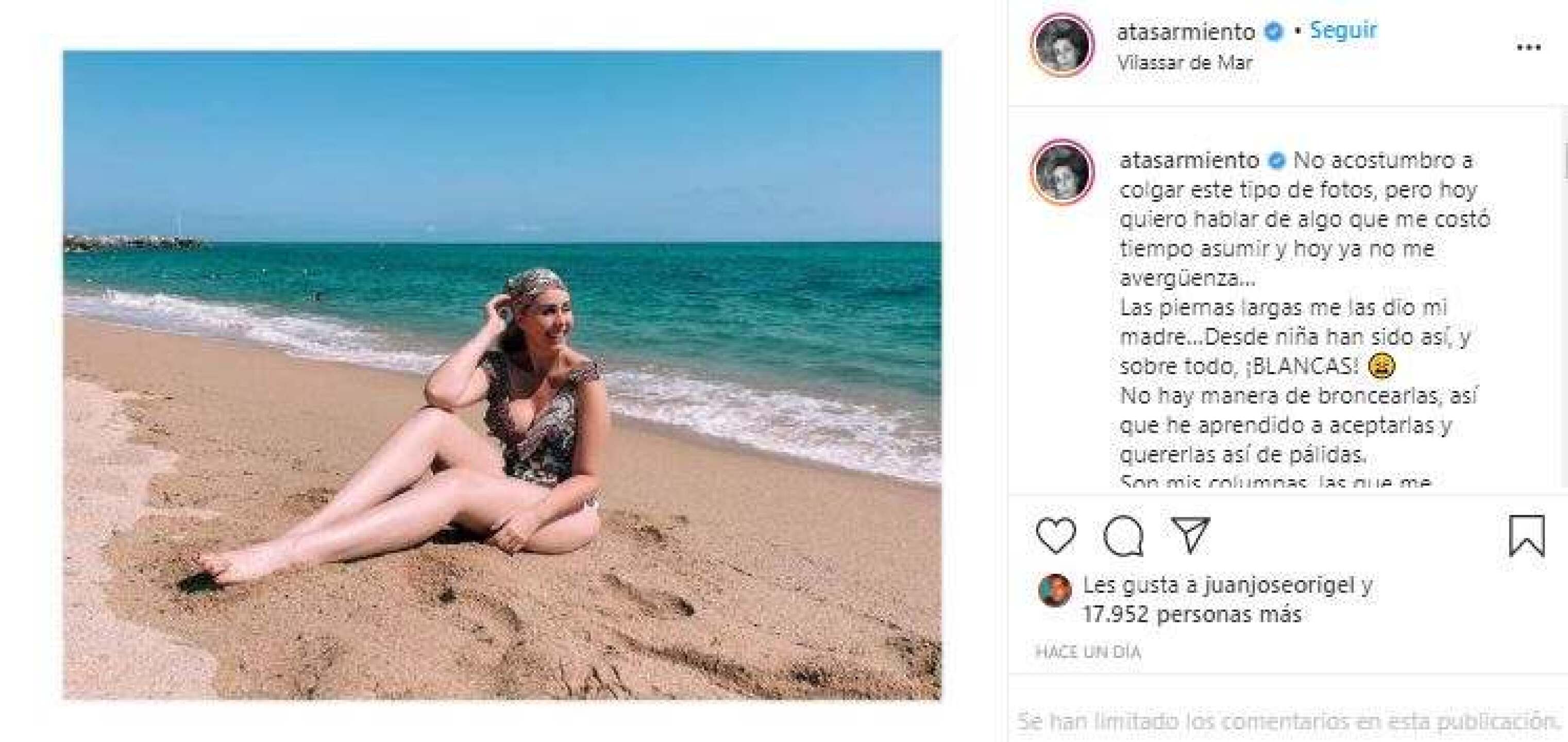 Atala Sarmiento  enseña vergüenza cuerpo