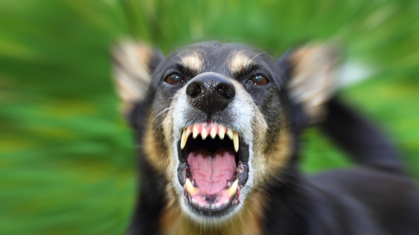 Madre e hijo fueron atacados brutalmente por perros salvajes.