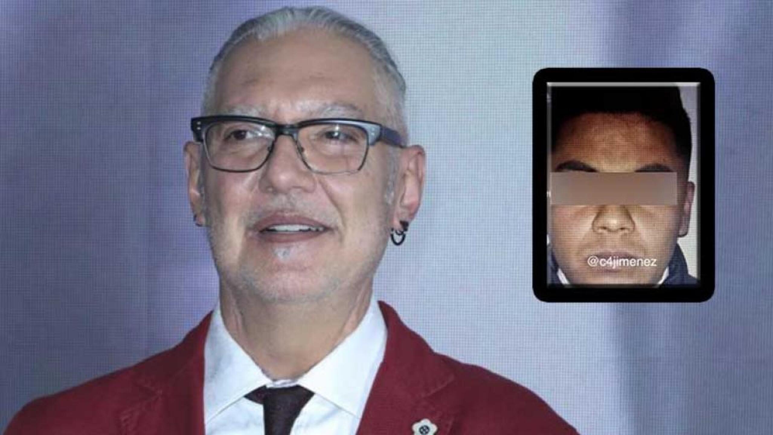 Sabo Romo habla sobre su salud tras perder la vista del ojo izquierdo