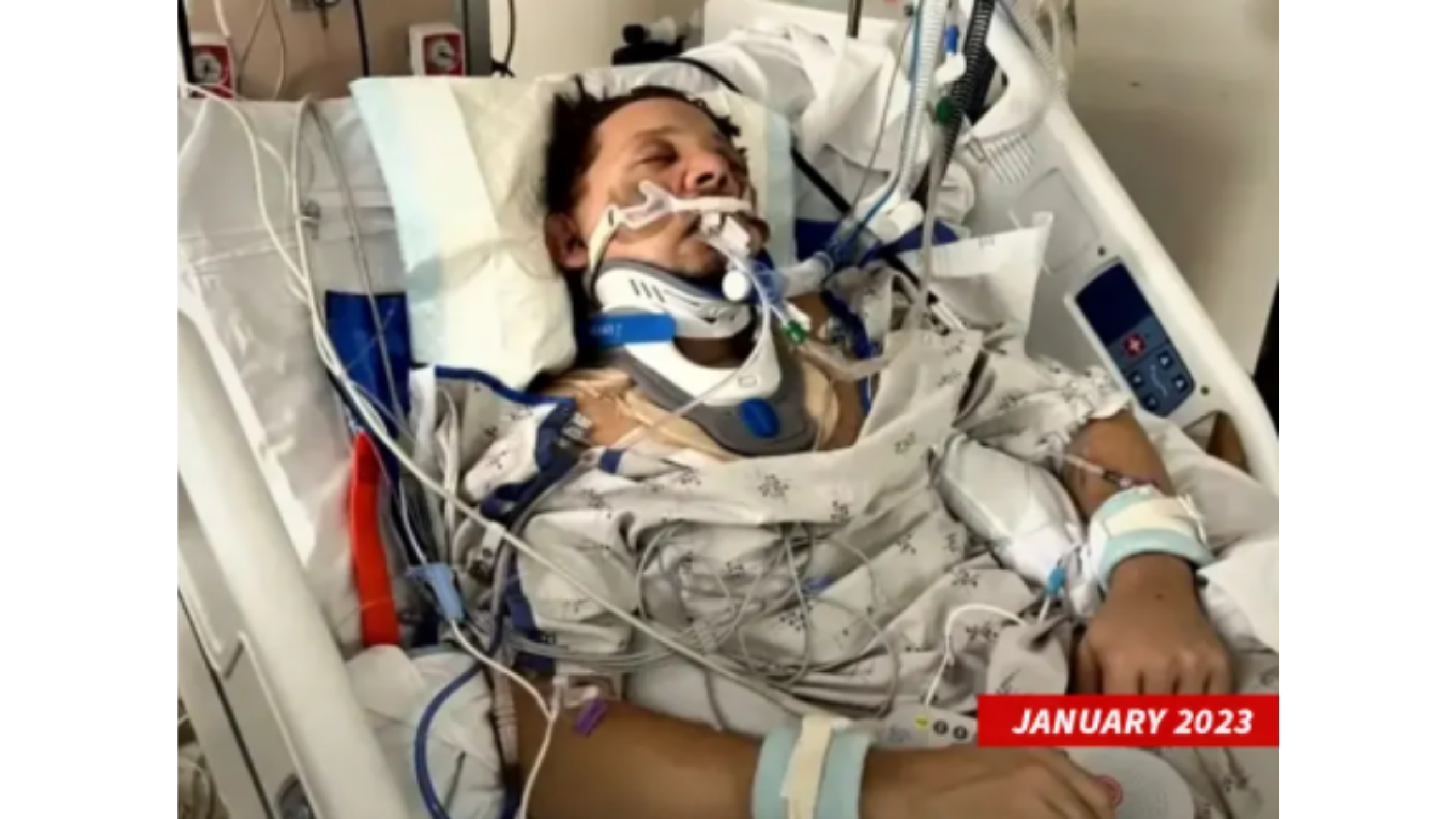 Jeremy Renner hospitalizado por accidente