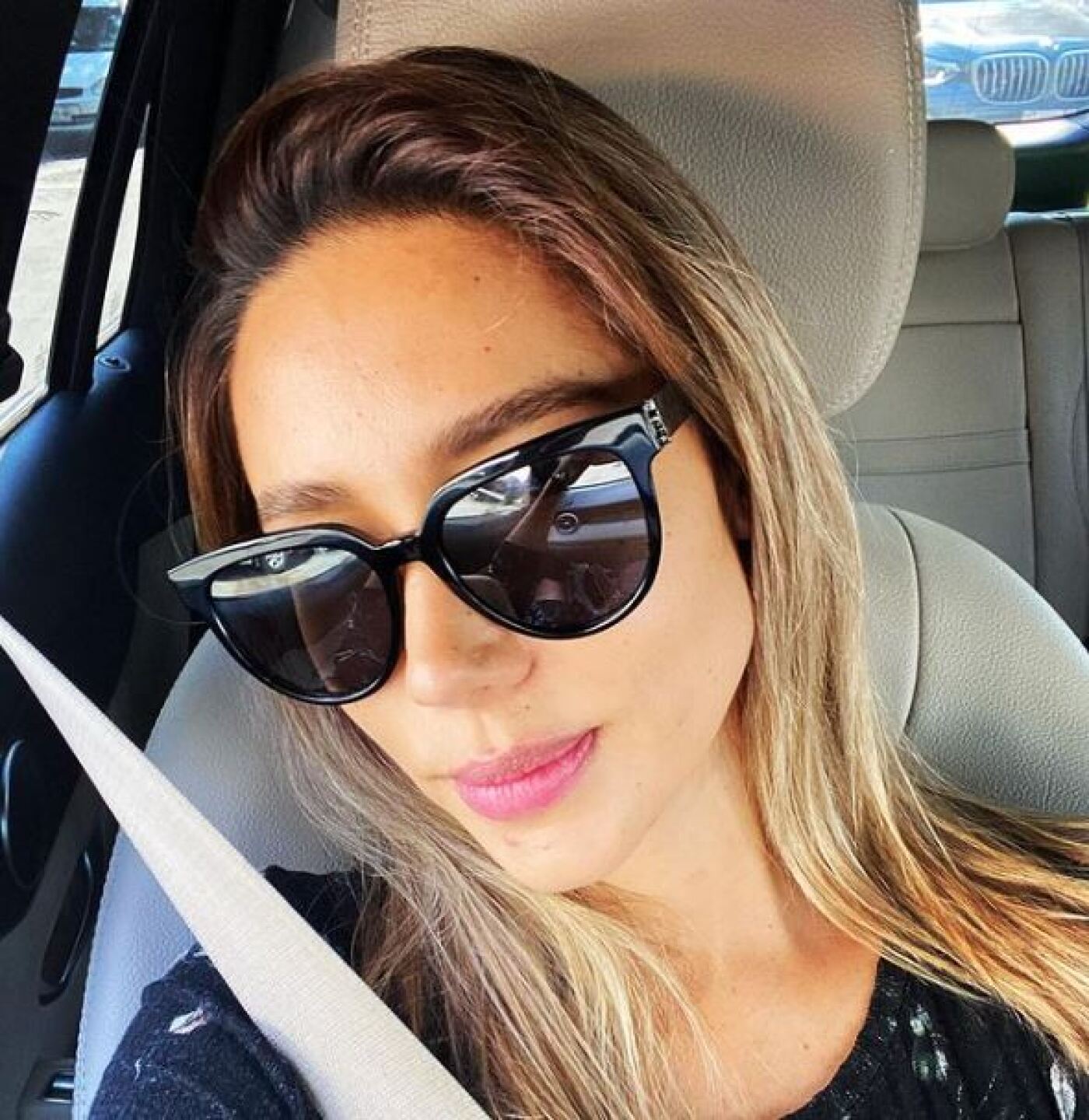 Marilé pudo haber perdido la mano en una explosión