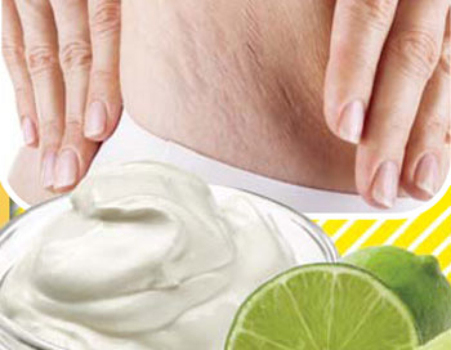Olvídate de las estrías con esta mezcla natural.