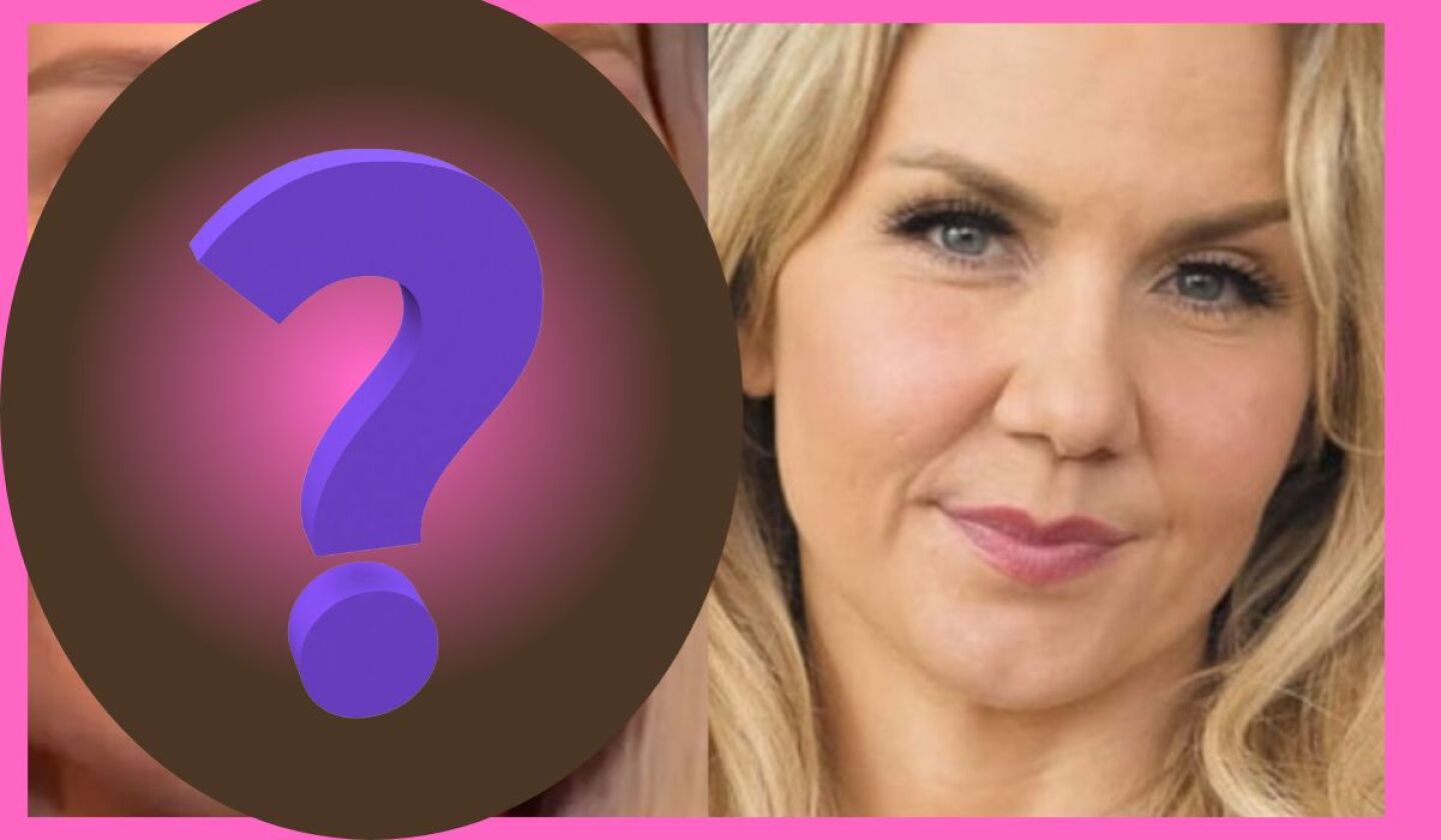 ¿Qué le pasó en la cara a Michelle Vieth? La actriz desata polémica por su nuevo rostro